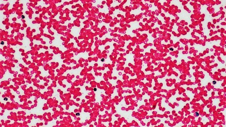 Connective Tissue: Human Blood Leukocyte Survey