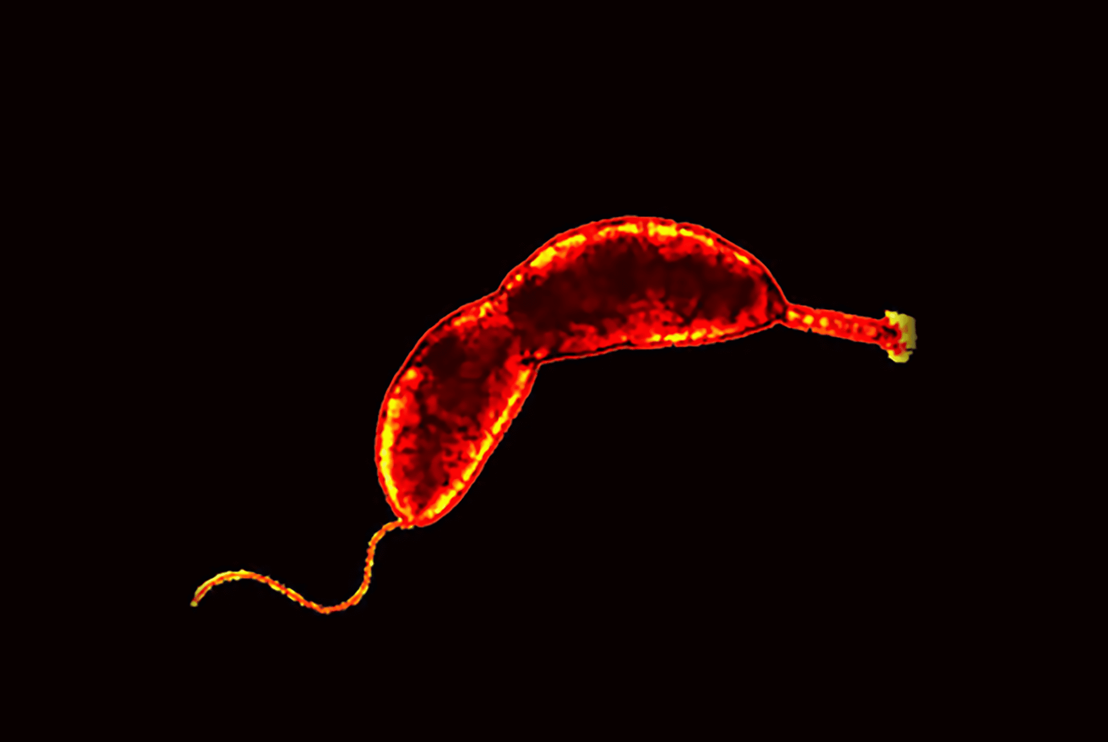 red, black and yellow bacteria against black background